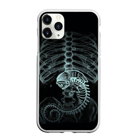 Чехол для iPhone 11 Pro матовый с принтом Чужой на Рентгене в Тюмени, Силикон |  | alien | больница | больной | внутренний мир | врач | клиника | кости | пациент | ребра | рентген | скелет | снимок | хищник