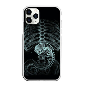 Чехол для iPhone 11 Pro Max матовый с принтом Чужой на Рентгене в Тюмени, Силикон |  | alien | больница | больной | внутренний мир | врач | клиника | кости | пациент | ребра | рентген | скелет | снимок | хищник