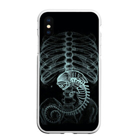 Чехол для iPhone XS Max матовый с принтом Чужой на Рентгене в Тюмени, Силикон | Область печати: задняя сторона чехла, без боковых панелей | alien | больница | больной | внутренний мир | врач | клиника | кости | пациент | ребра | рентген | скелет | снимок | хищник